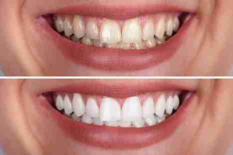 Image Source - Emergency Dentist  Newport